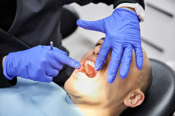 Best Emergency Tooth Extraction in St George, KS