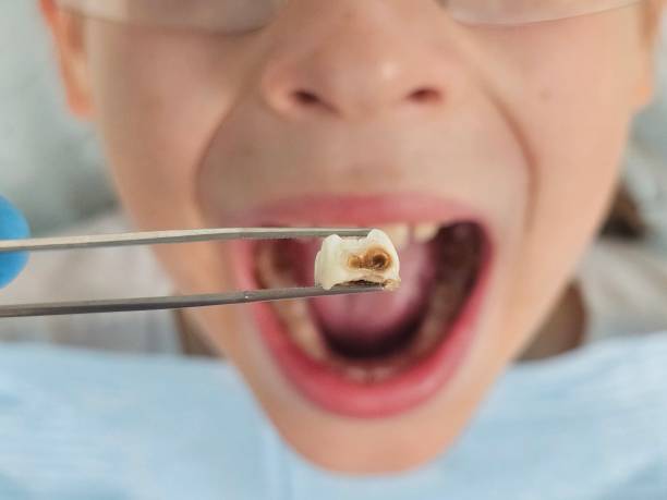 Best Pediatric Emergency Dentist in St George, KS